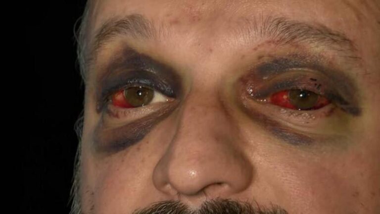 Les peines des 8 accusés qui ont battu le musicien pour sa musique &lsquo;çiftetelli&rsquo; ont été annoncées.