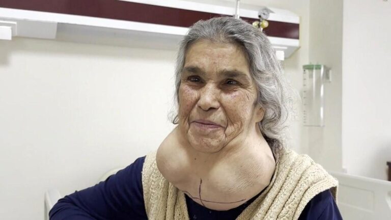 Il a vécu avec une masse énorme pendant 50 ans !  Voici pourquoi