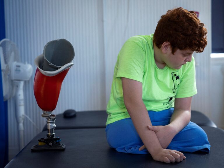 Les pas pénibles d&rsquo;un garçon sur des jambes prothétiques après le tremblement de terre en Turquie |  Séisme Turquie-Syrie