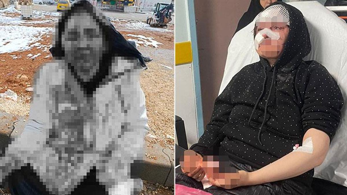 En un mot, brutalité ! Il a plongé sa femme, qui voulait divorcer, dans le coma avec des pierres : Cani a été arrêté