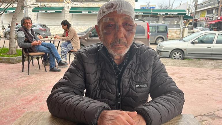 Incident incroyable à Kocaeli. Ils ont d’abord voulu utiliser un briquet, puis ils l’ont emmené à l’hôpital.