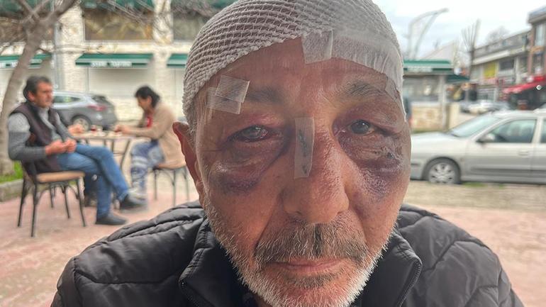 Incident incroyable à Kocaeli. Ils ont d’abord voulu utiliser un briquet, puis ils l’ont emmené à l’hôpital.