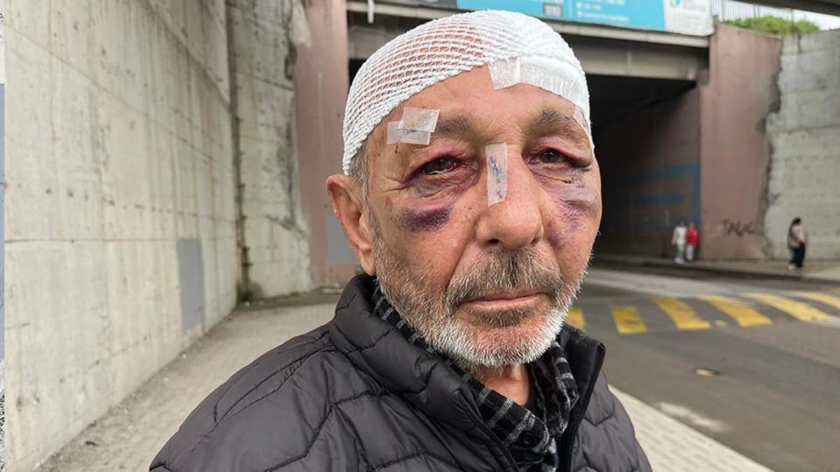 Événement incroyable à Kocaeli ! Ils ont d’abord voulu lui donner un briquet, puis ils l’ont envoyé à l’hôpital.